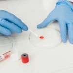 5 selected hematology services in Siegen – specialist examination of blood count changes and blood diseases