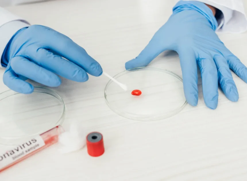 5 selected hematology services in Siegen – specialist examination of blood count changes and blood diseases