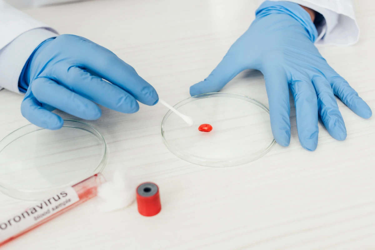 5 selected hematology services in Siegen – specialist examination of blood count changes and blood diseases